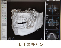 CTスキャン