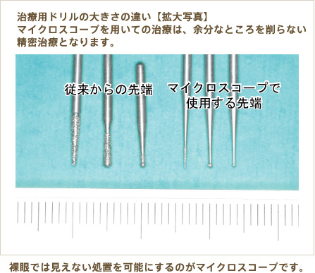 治療用ドリルの大きさの違い【拡大写真】マイクロスコープを用いての治

療は、余分なところを削らない精密治療となります。