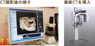 CT撮影後の様子　最新CT導入